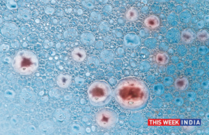 Fortis Hospital administers the first antibody cocktail-thisweekindia