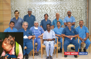 Aster CMI doctors successfully remove more than 8kg hanging tumor on the face of a 31-year-old Man - thisweekindia