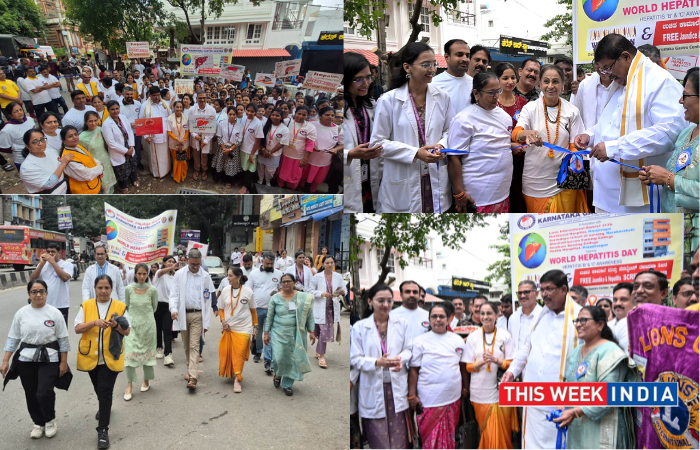 Bengaluru Takes a Stand Against Hepatitis on World Hepatitis Day - thisweekindia