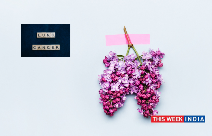 A Growing Concern Lung Cancer in Non-Smokers - thisweekindia