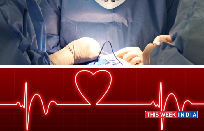 Fortis Hospital Nagarbhavi Saves Young Siblings with Life-Saving Heart Bypass Surgeries - thisweekindia