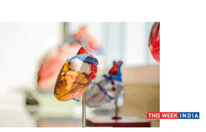 World's First Non-Surgical Valve Replacement After Ring Repair at Fortis - thisweekindia