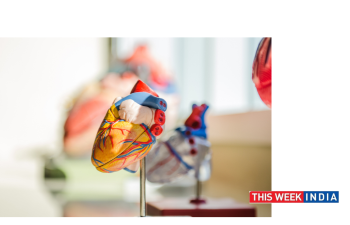 World's First Non-Surgical Valve Replacement After Ring Repair at Fortis - thisweekindia