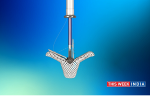 Abbott Launches Innovative TriClip™ System in India - thisweekindia