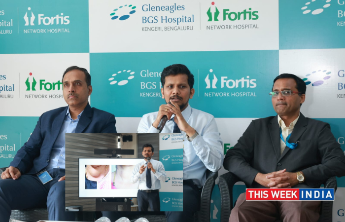 Gleneagles BGS Performs Breakthrough Non-Surgical Thyroid Treatment - thisweekindia