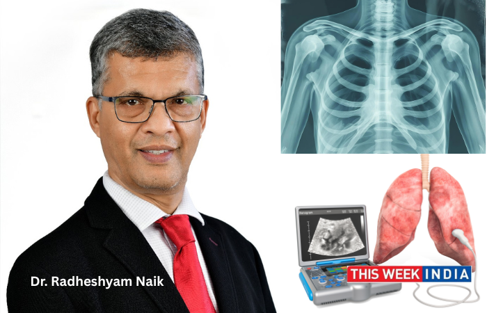 Lung Cancer Rising Among Young Adults Women, and Non Smokers - thisweekindia