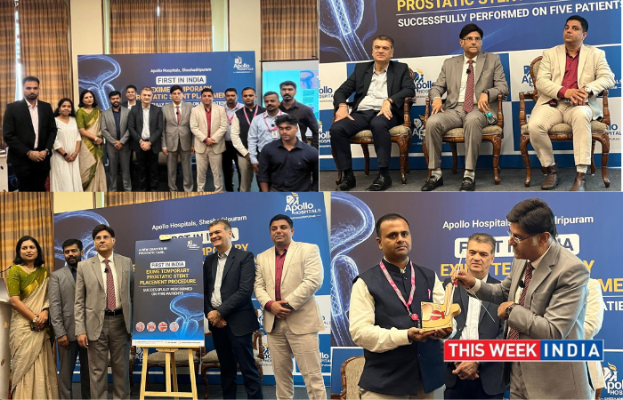 Apollo Hospitals, Bengaluru Pioneers India's First EXIME Temporary Prostatic Stent Procedures - thisweekindia